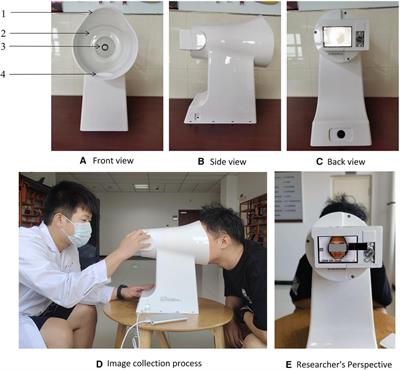 Feasibility of tongue image detection for coronary artery disease: based on deep learning